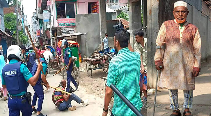জুলাইয়ে পুলিশের মার, পরে স্ট্রোক— অর্থাভাবে বন্ধ সাংবাদিক শামীম মামার চিকিৎসা